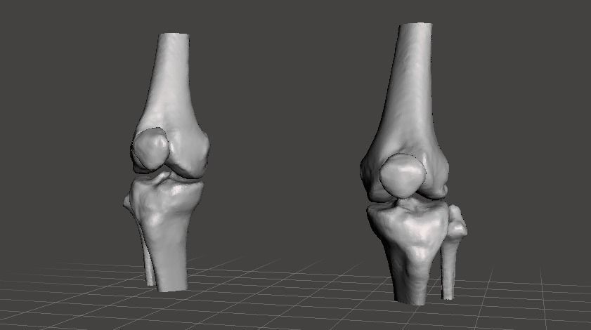 Knee joint - female 3D model_1