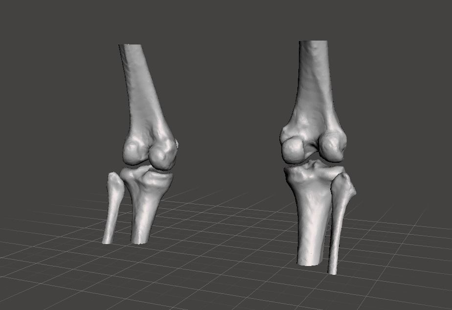 Knee joint - female 3D model_3