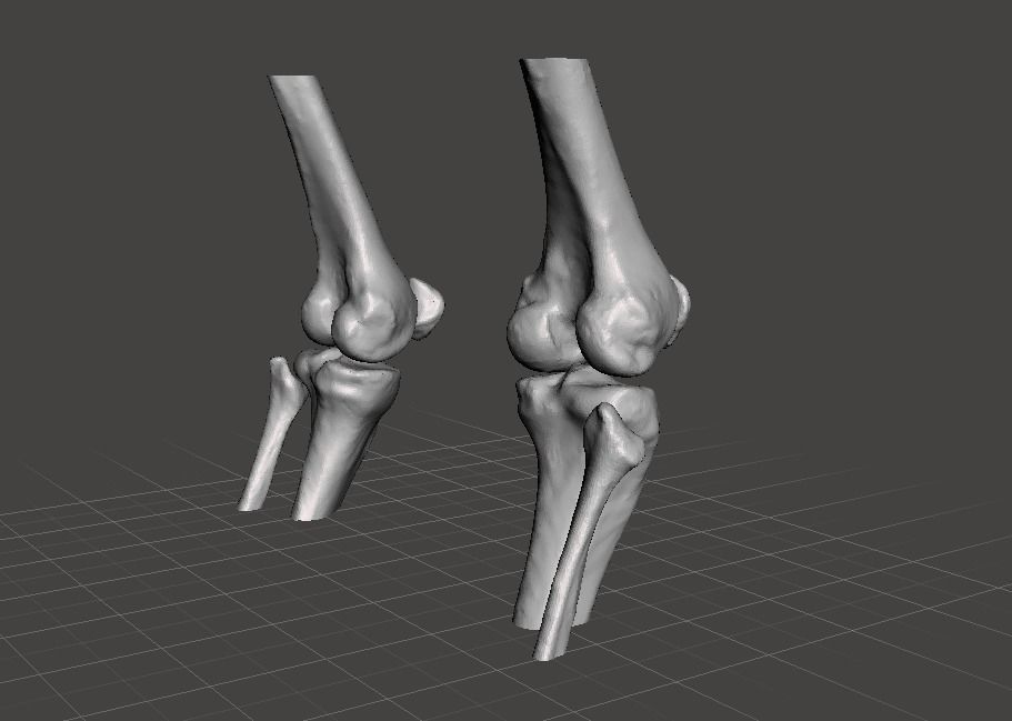 Knee joint - female 3D model_5