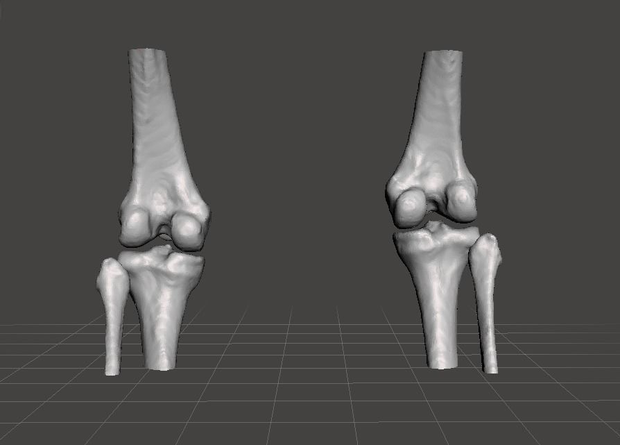 Knee joint - female 3D model_4