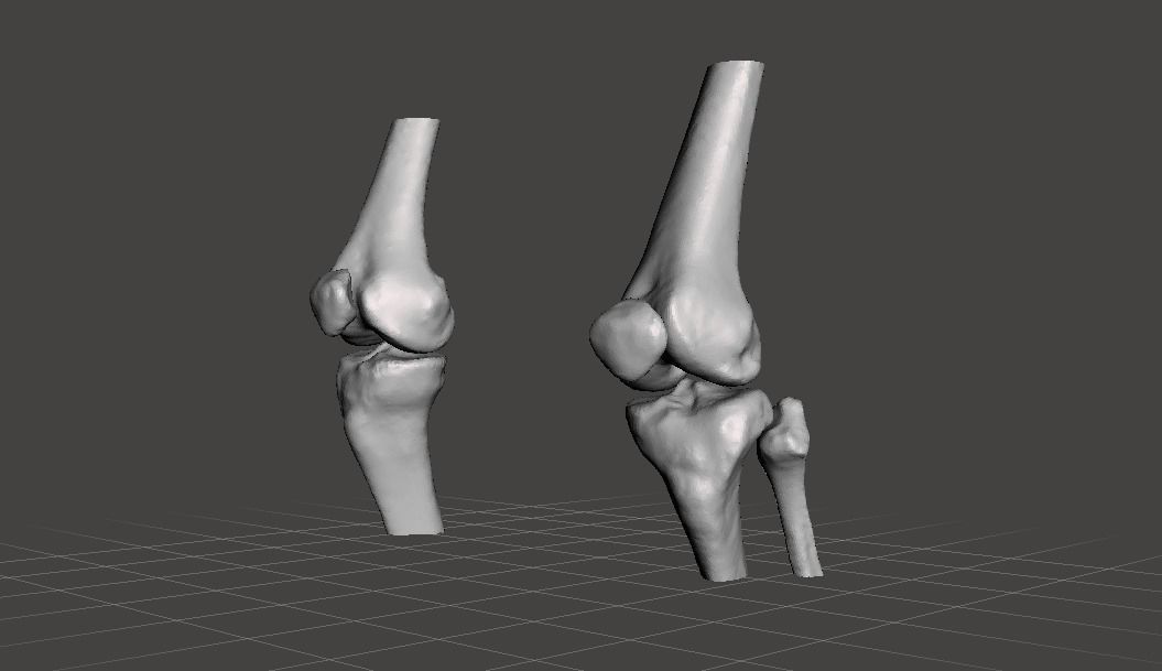 Knee joint - female 3D model_2