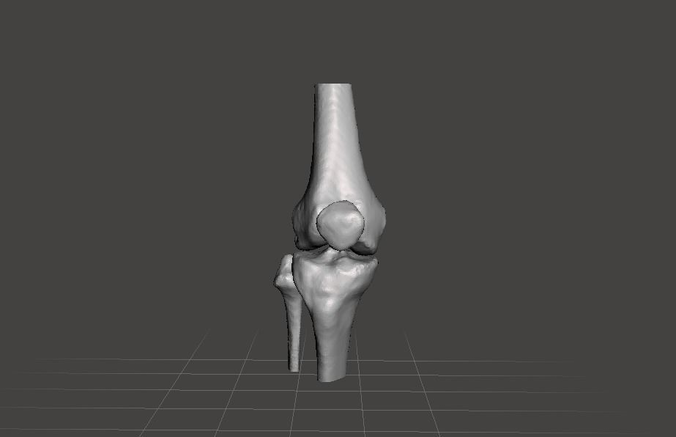 Right knee joint - female 3D model 3D model