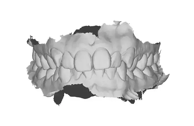 P017 - Dental - Intraoral Scan STL-PLY-OBJ