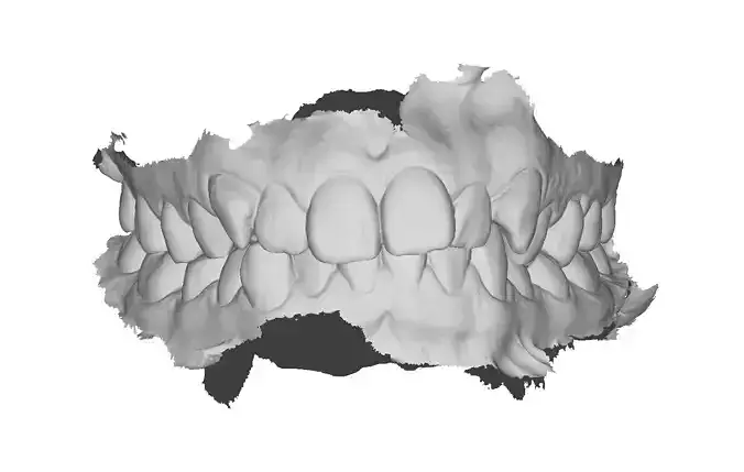 P018 - Dental - Intraoral Scan STL-PLY-OBJ