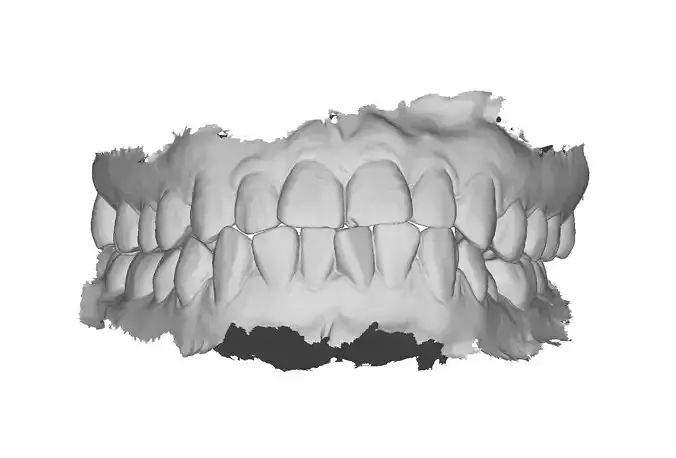 P022 - Dental - Intraoral Scan STL-PLY-OBJ