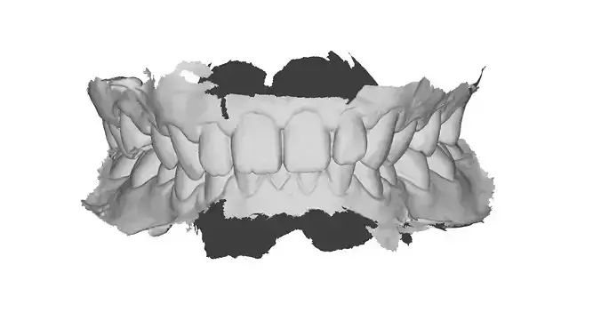 P023 - Dental - Intraoral Scan STL-PLY-OBJ 3D print model