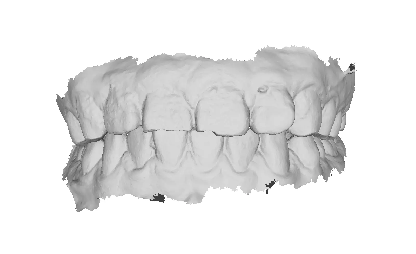 P024 - Dental - Intraoral Scan STL-PLY-OBJ 3D print model_0
