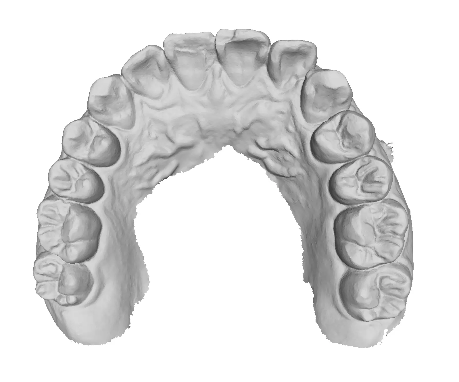 P024 - Dental - Intraoral Scan STL-PLY-OBJ 3D print model_1