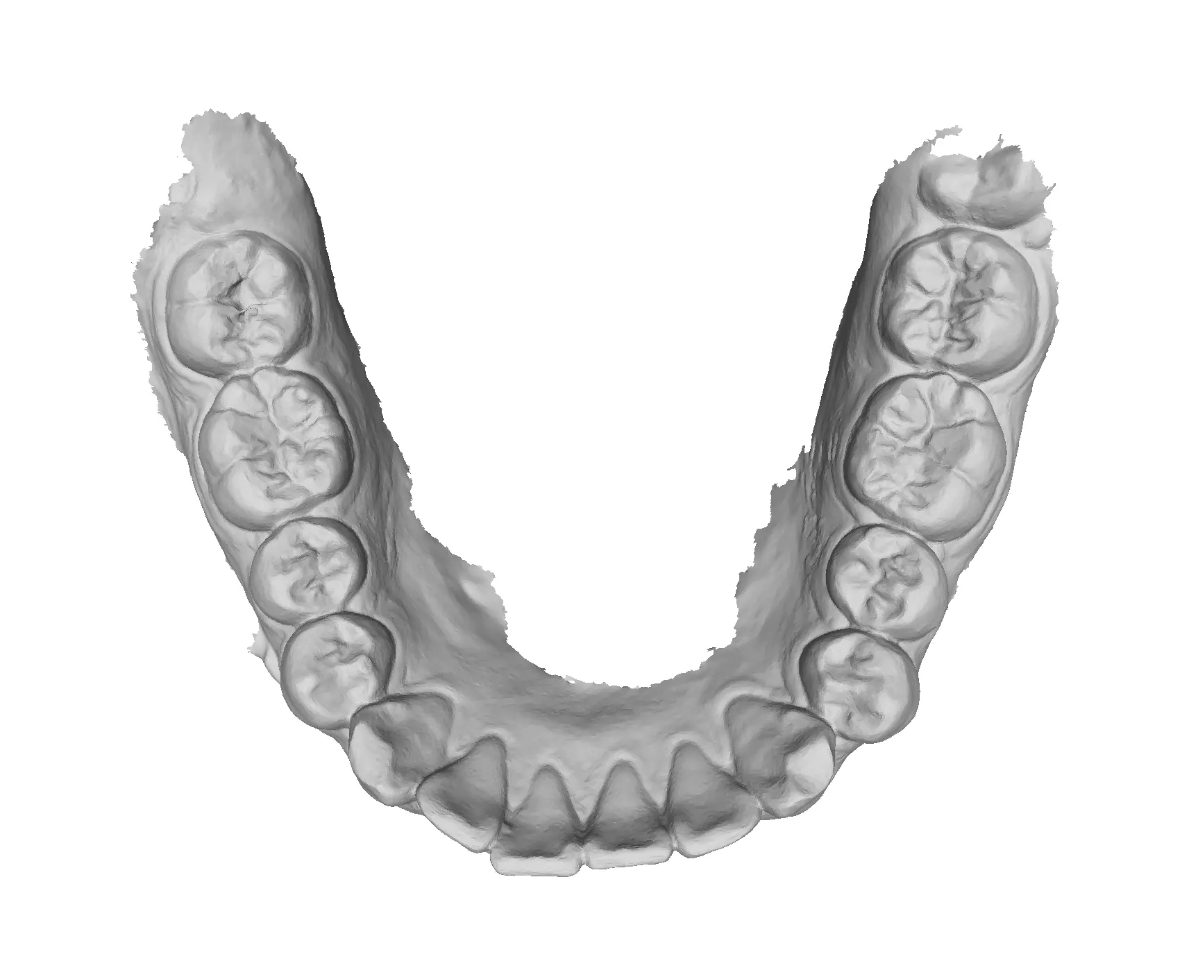 P024 - Dental - Intraoral Scan STL-PLY-OBJ 3D print model_2