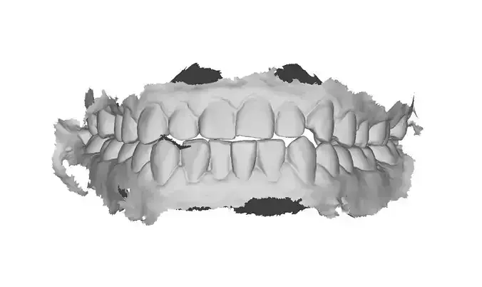 P028 - Dental - Intraoral Scan STL-PLY-OBJ