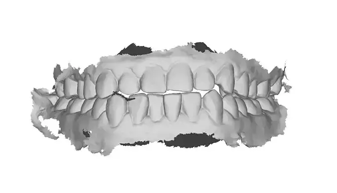 P029 - Dental - Intraoral Scan STL-PLY-OBJ