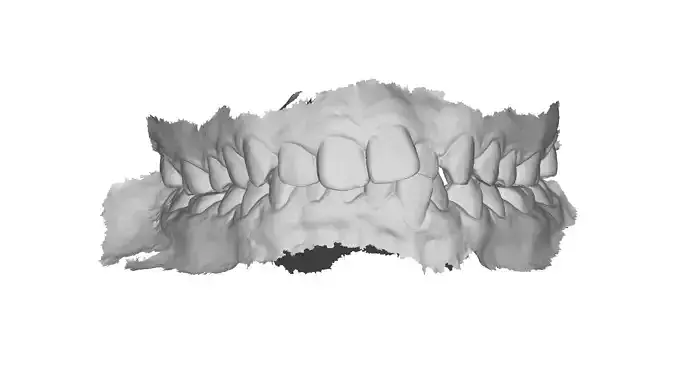 P033 - Dental - Intraoral Scan STL-PLY-OBJ