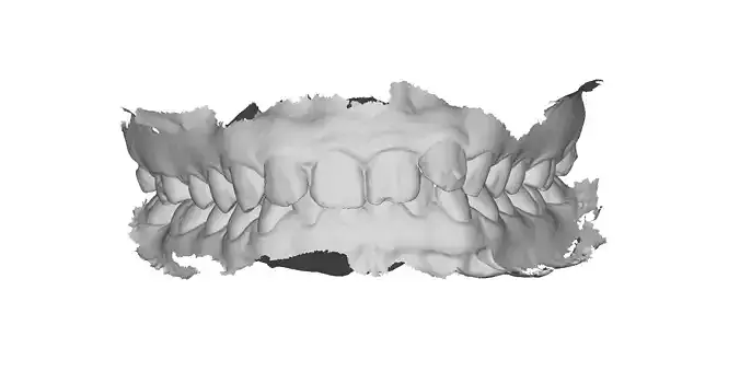 P034 - Dental - Intraoral Scan STL-PLY-OBJ 3D print model