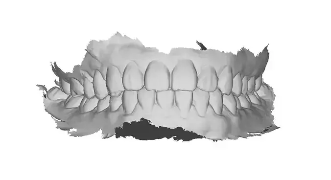 P039 - Dental - Intraoral Scan STL-PLY-OBJ