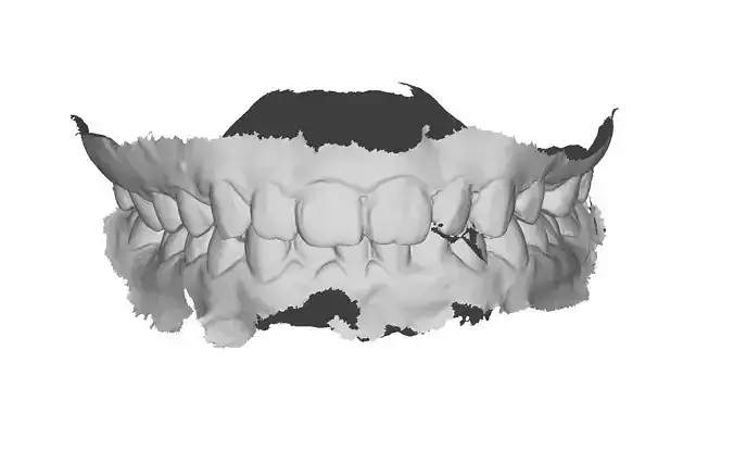 P035 - Dental - Intraoral Scan STL-PLY-OBJ 3D print model