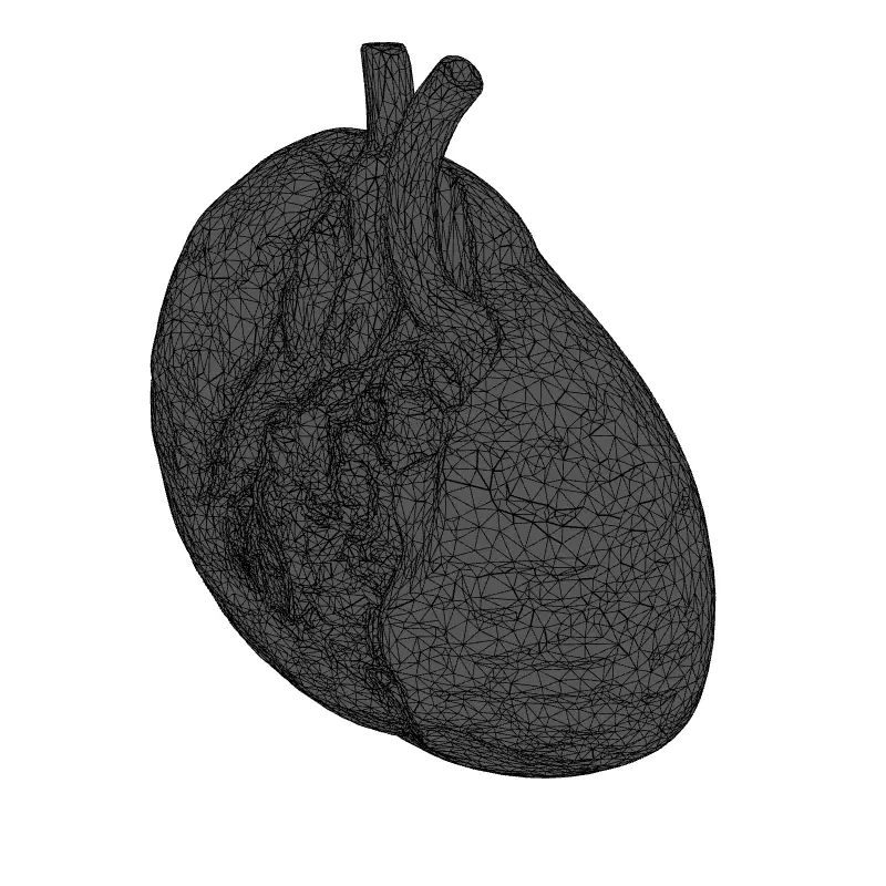 Healthy vs Cirrhotic Liver 3D Model Low-poly 3D model_9