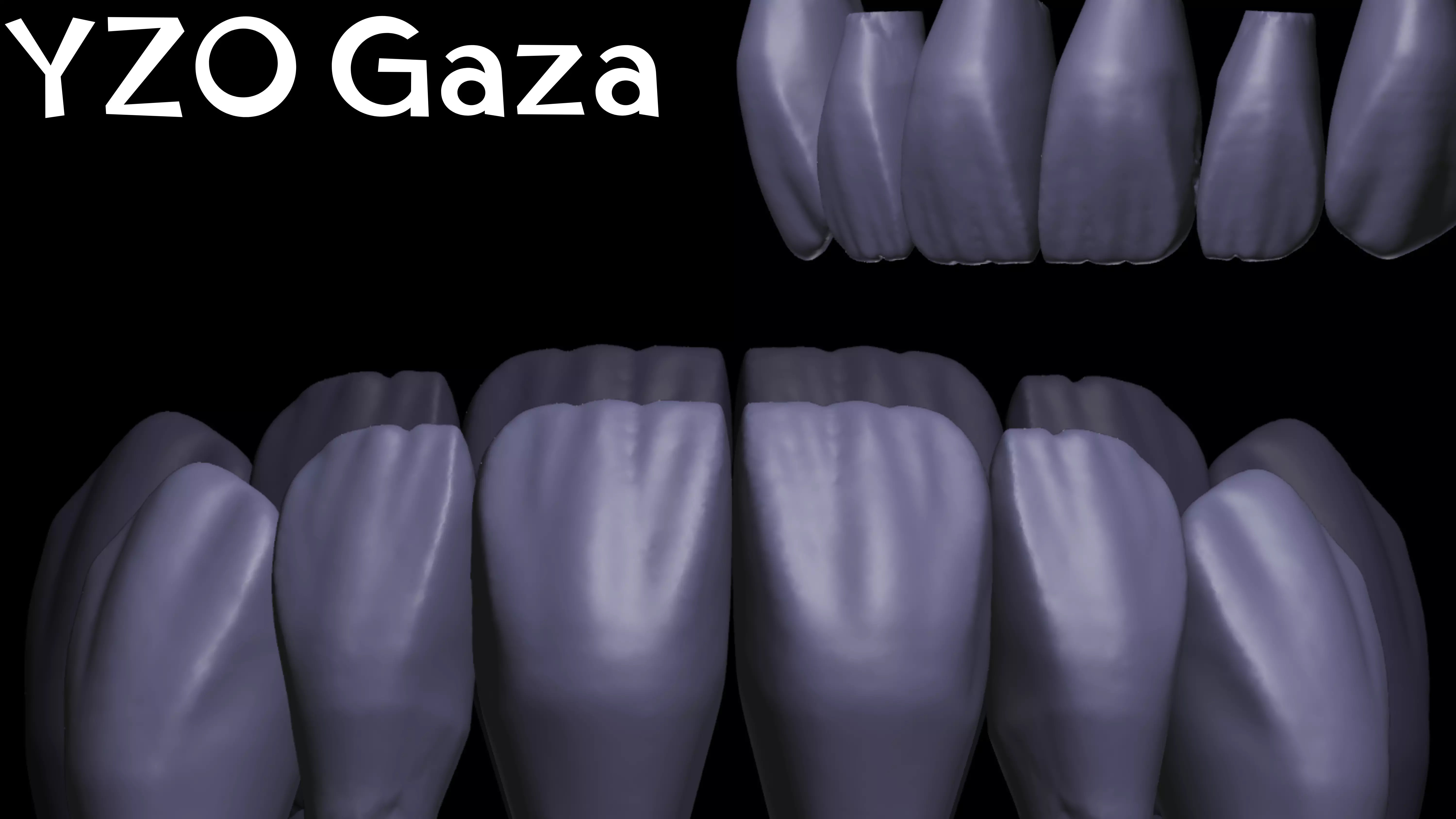 YZO Library Exocad library 3D print model_14