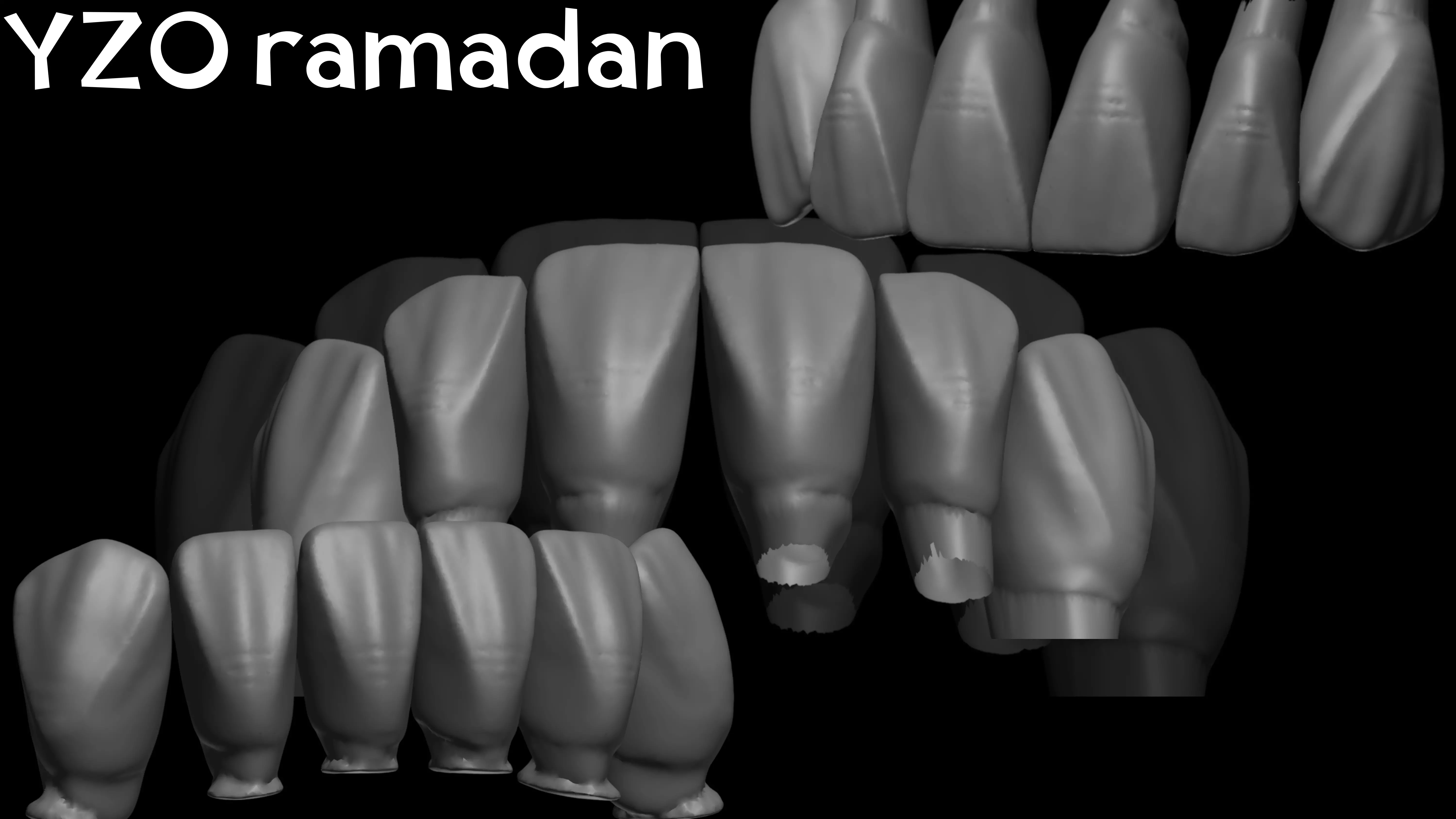 YZO Library Exocad library 3D print model_15