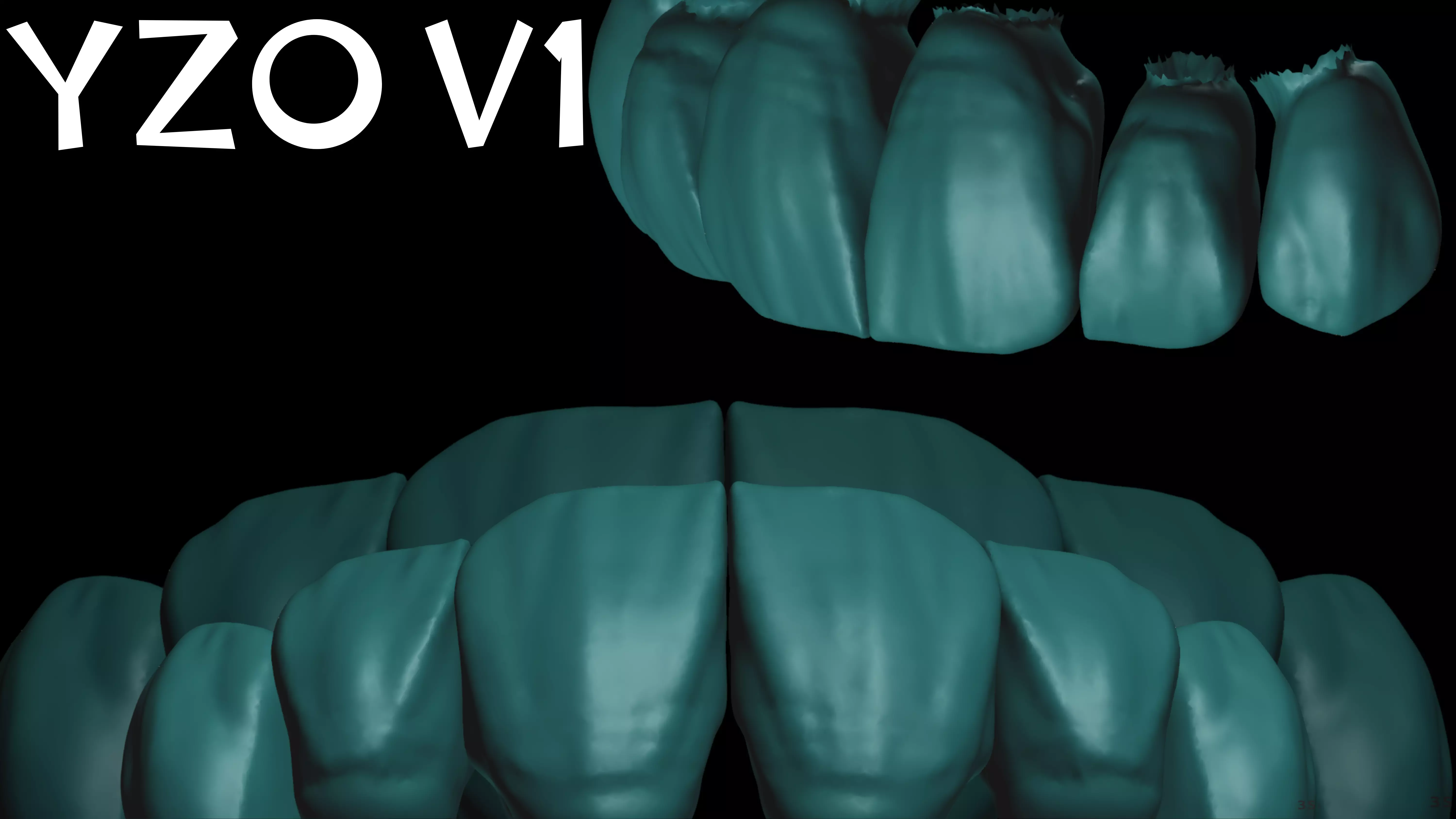 YZO Library Exocad library 3D print model_8