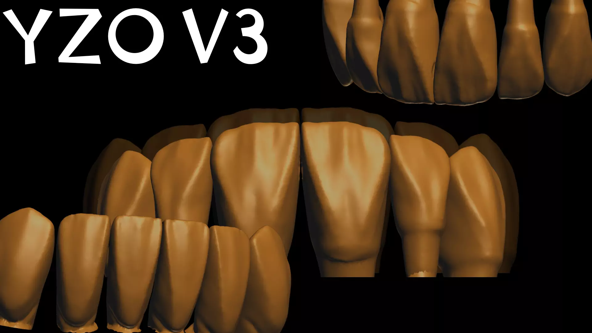YZO Library Exocad library 3D print model_10
