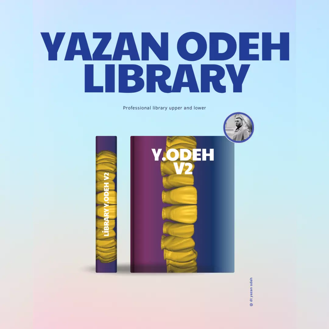 YZO Library Exocad library 3D print model_1