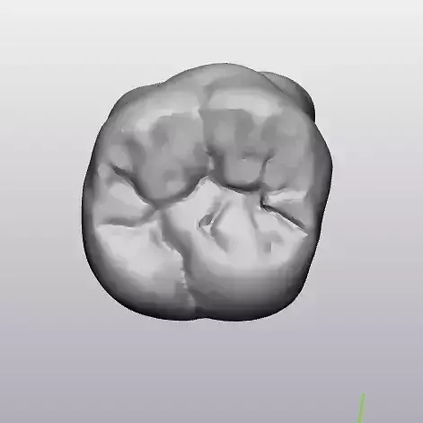 natural tooth maxilla upper arch