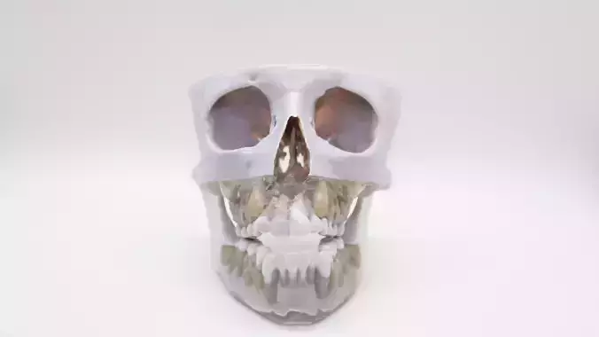 Palatal Expansion Model 3D print model