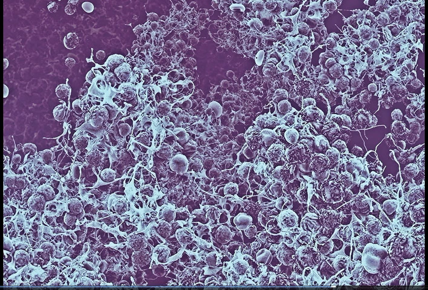 8 lymphocytes cells asset ZTL 3D model_15