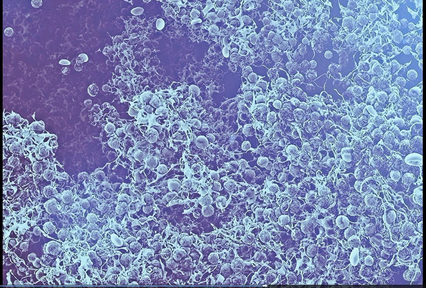 8 lymphocytes cells asset ZTL 3D model_17