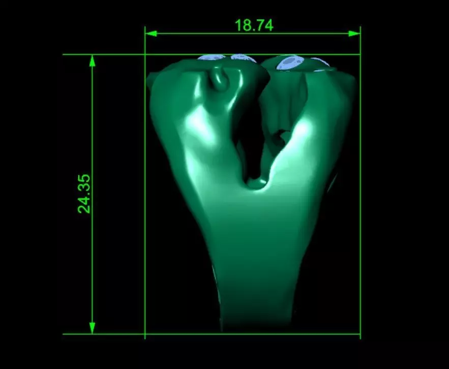 Colored Gemstone Ring- Heavy and Light Versions 3D print model_7