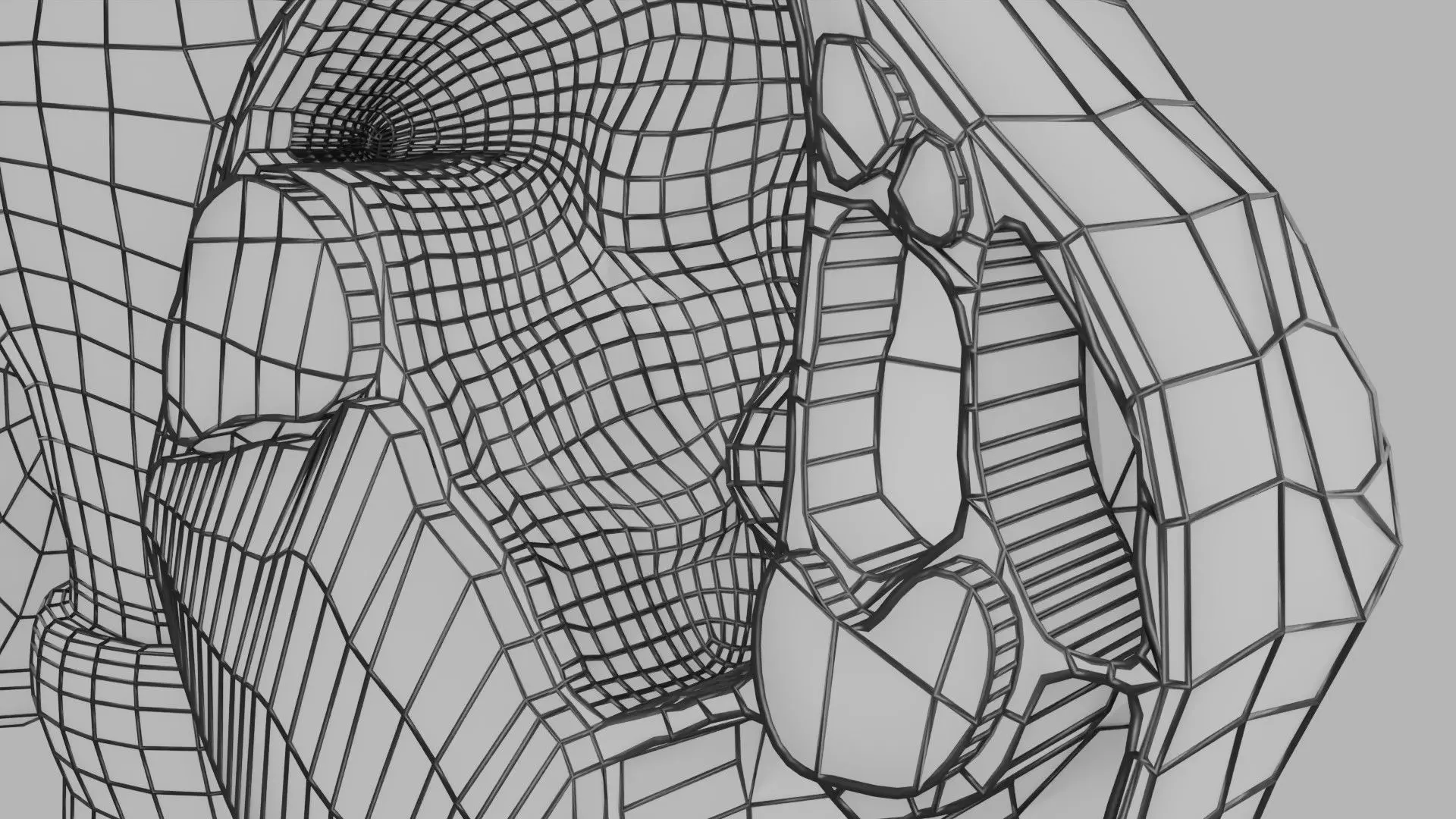 ovary mucinous cystic tumor  Low-poly 3D model_27