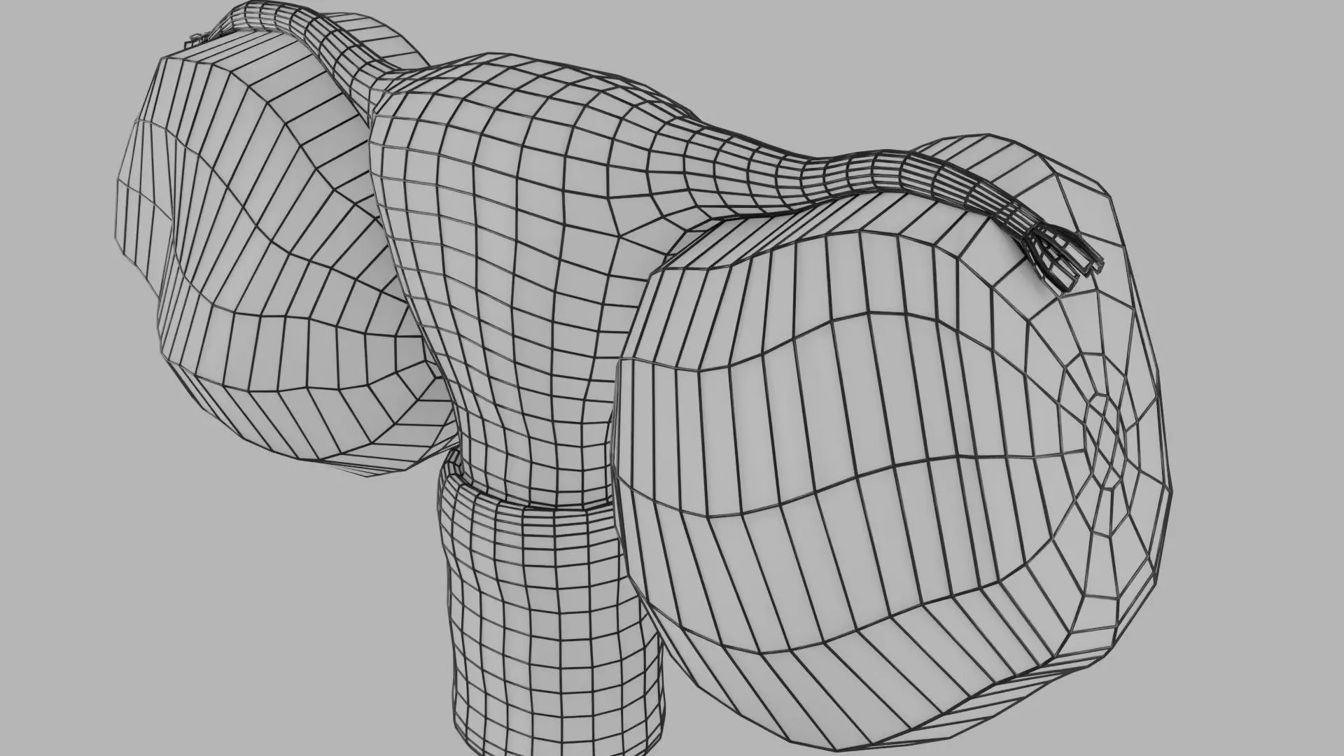 ovary mucinous cystic tumor  Low-poly 3D model_31