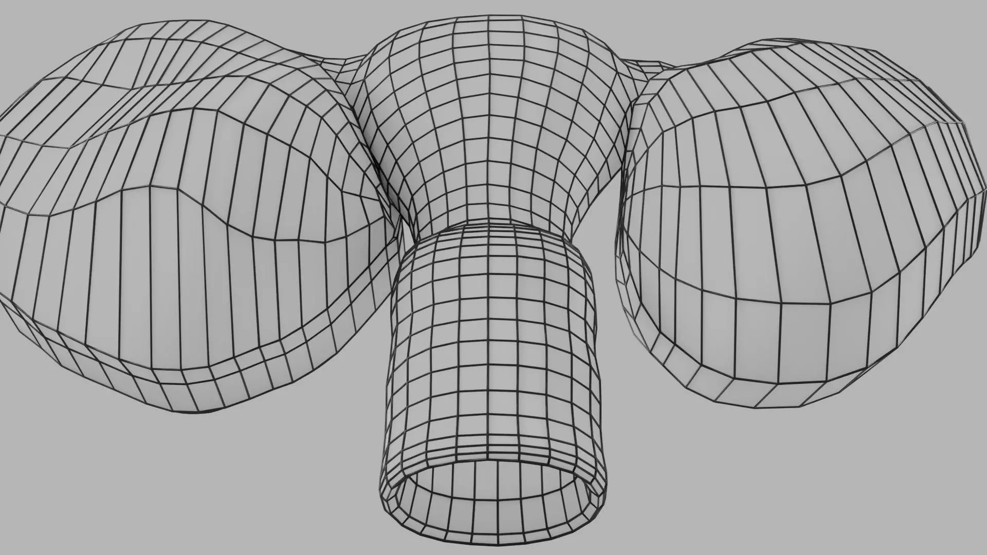 ovary mucinous cystic tumor  Low-poly 3D model_37