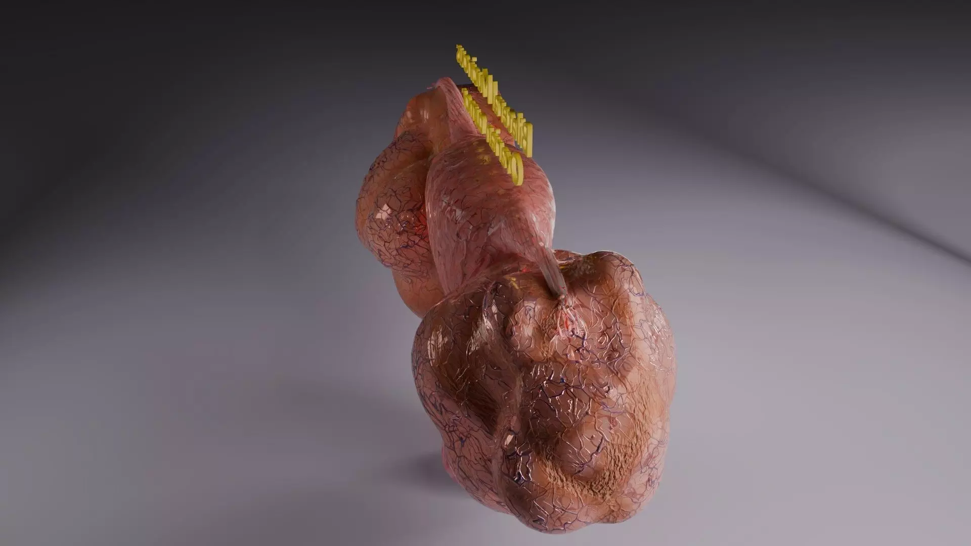 ovary mucinous cystic tumor  Low-poly 3D model_43