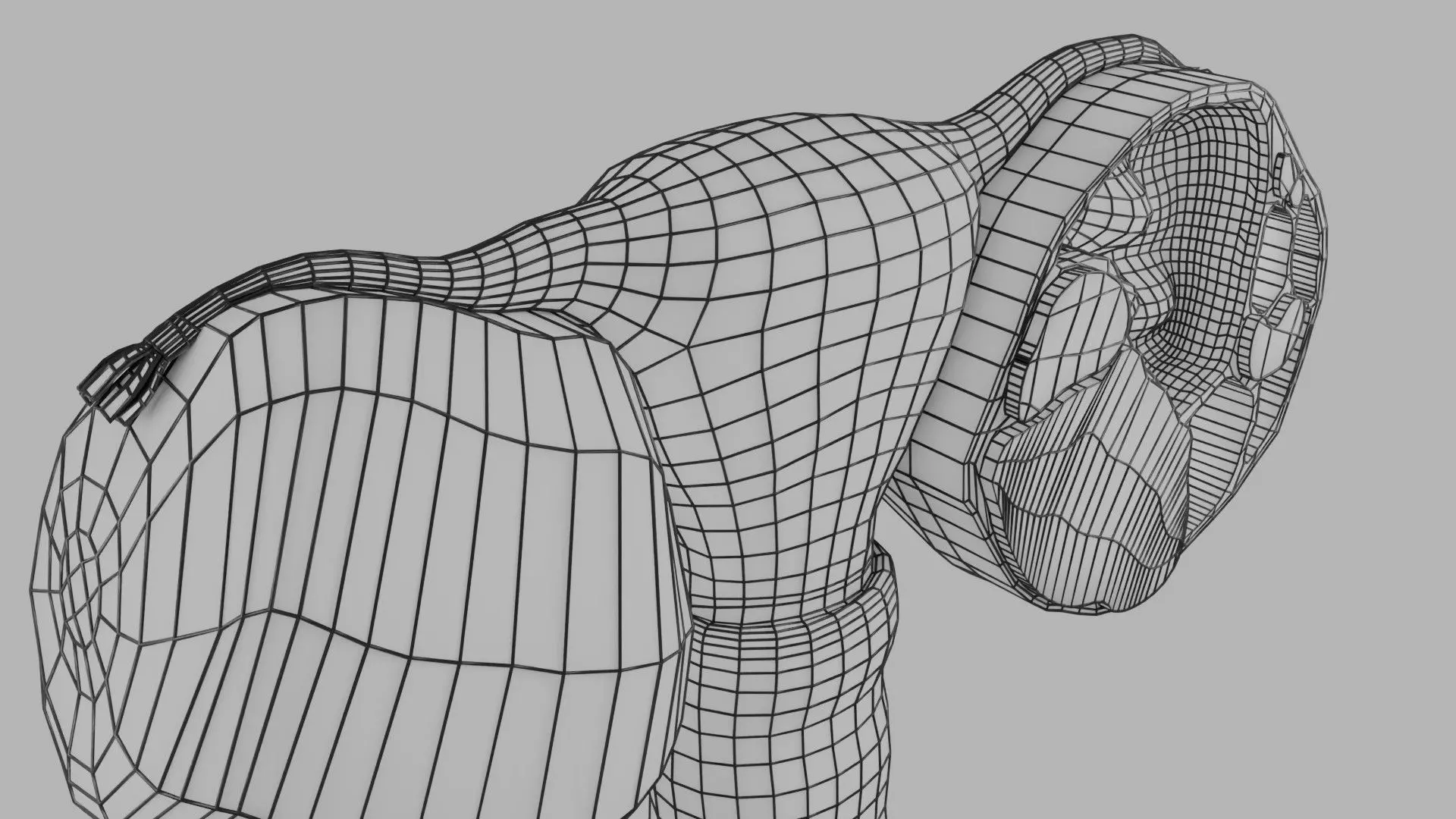 ovary mucinous cystic tumor  Low-poly 3D model_24