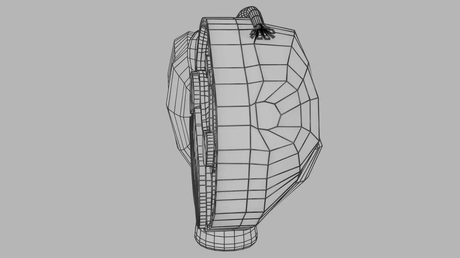 ovary mucinous cystic tumor  Low-poly 3D model_22