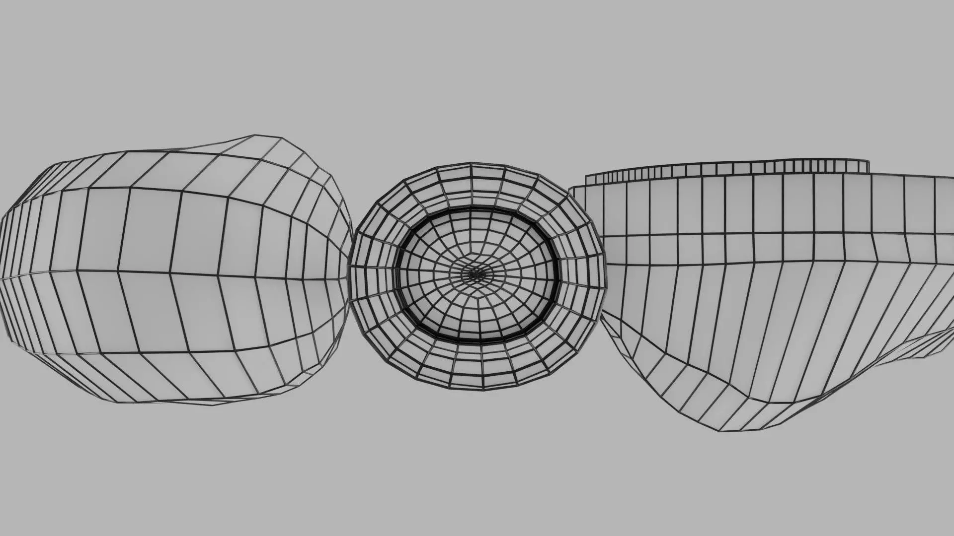 ovary mucinous cystic tumor  Low-poly 3D model_32