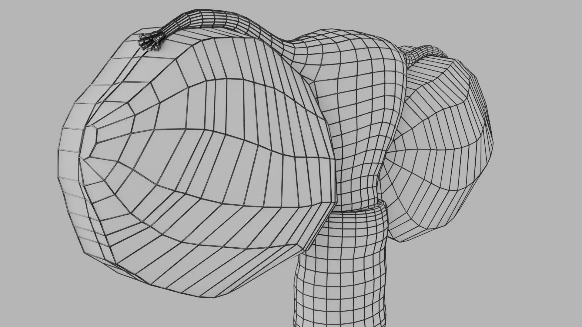 ovary mucinous cystic tumor  Low-poly 3D model_28