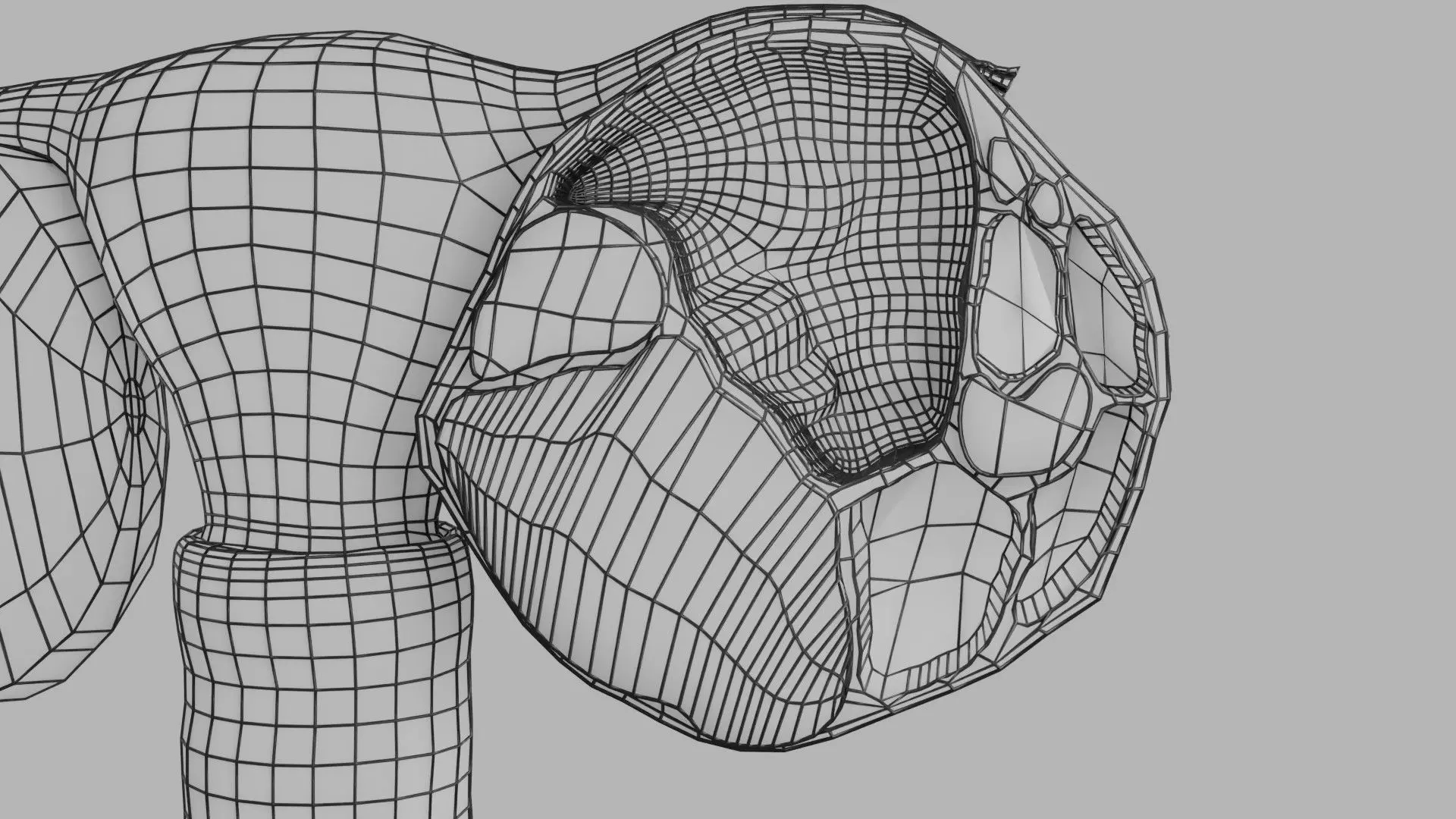 ovary mucinous cystic tumor  Low-poly 3D model_25