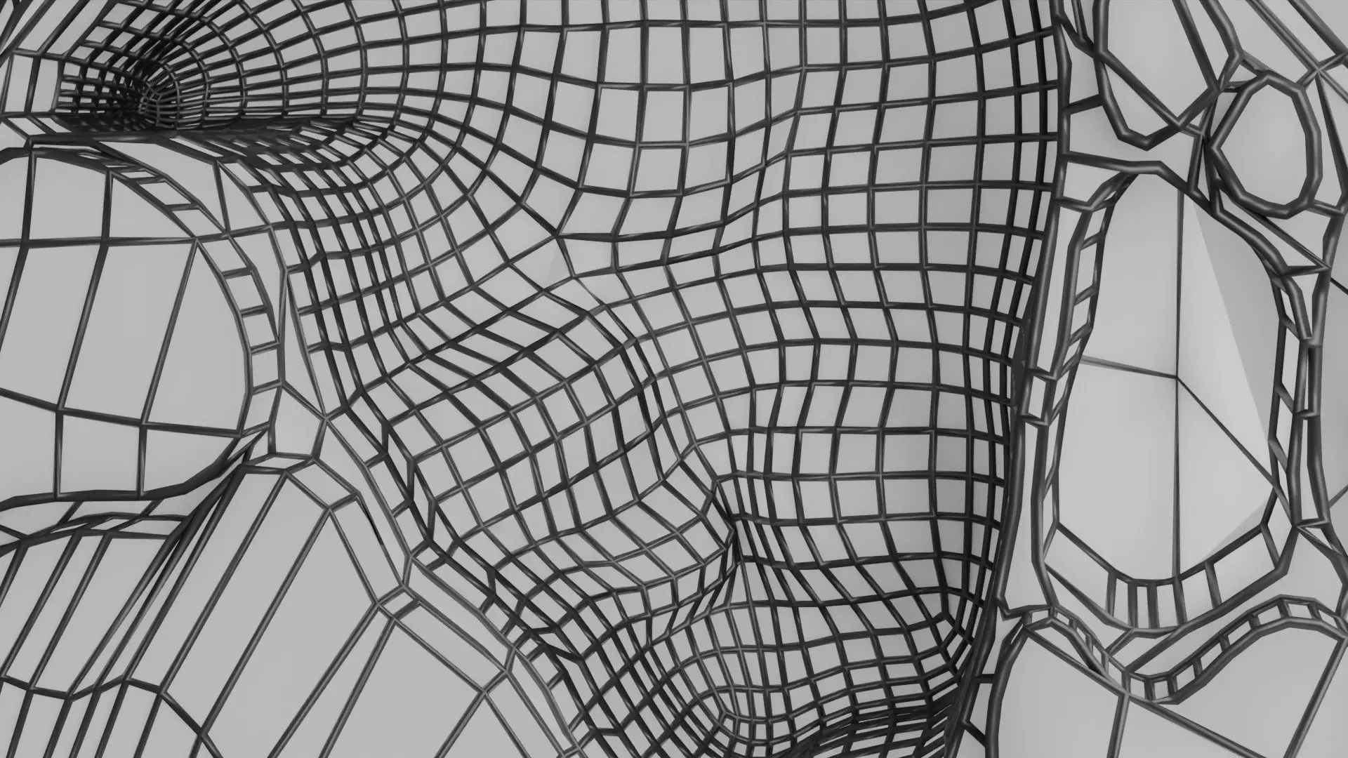 ovary mucinous cystic tumor  Low-poly 3D model_35