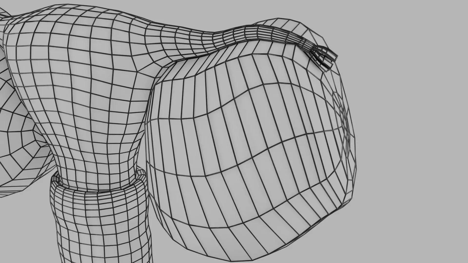 ovary mucinous cystic tumor  Low-poly 3D model_30