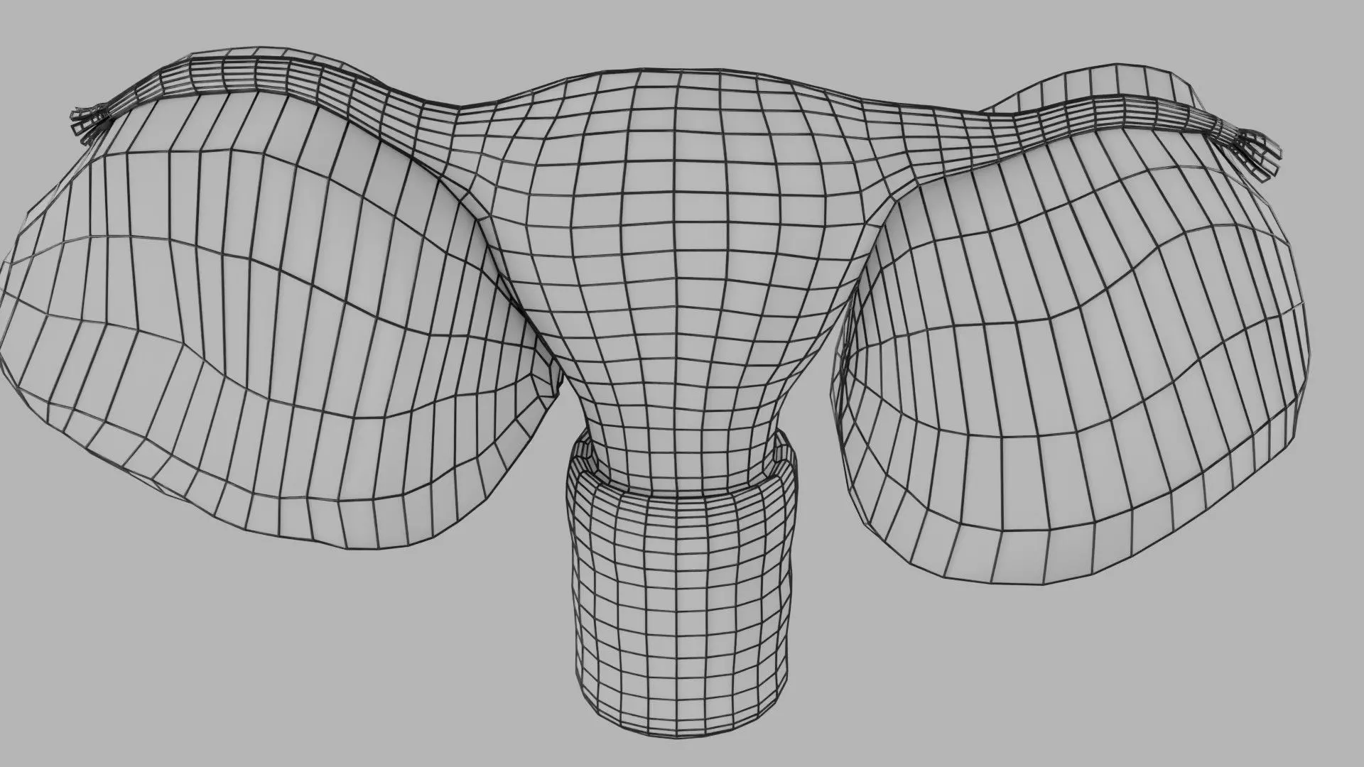 ovary mucinous cystic tumor  Low-poly 3D model_33