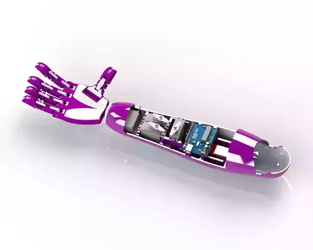 3d printed prosthetic limb