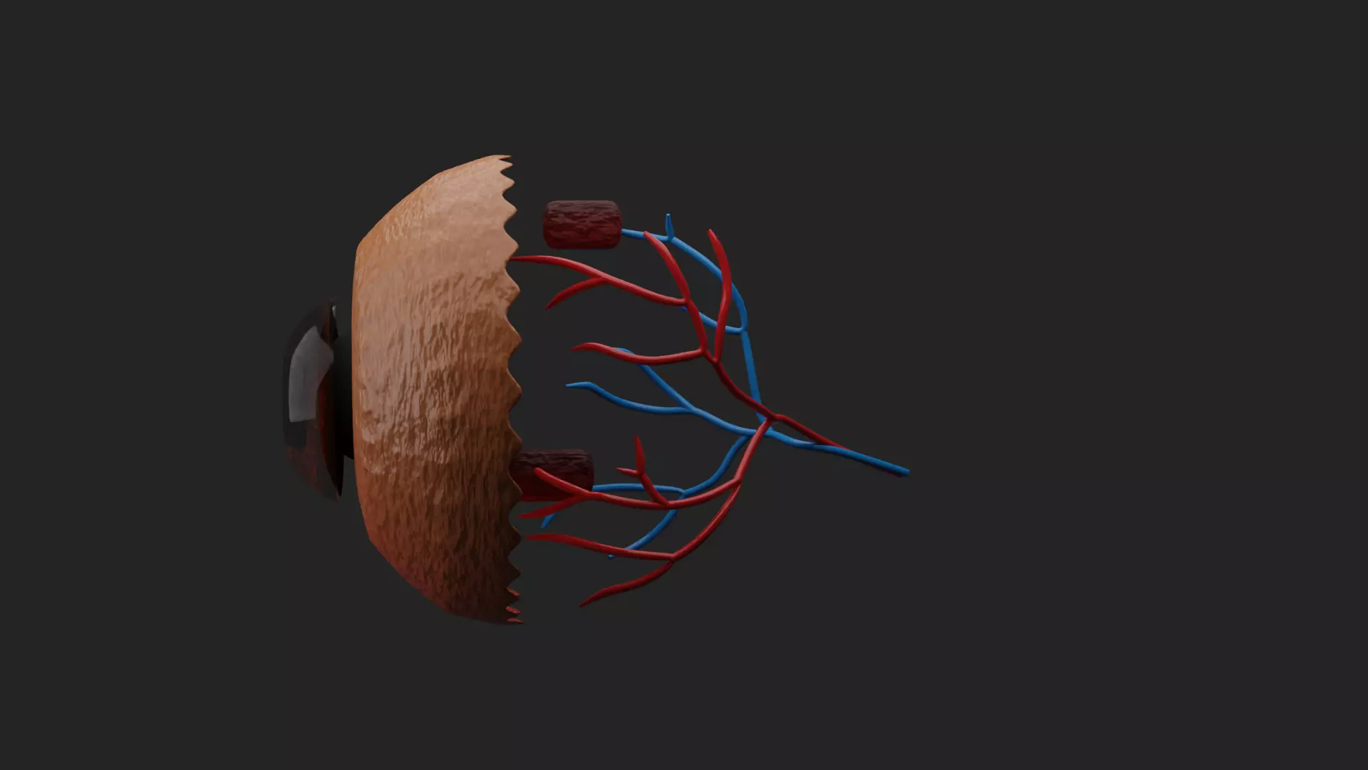 Cataract Eye Anatomy  3D model_7