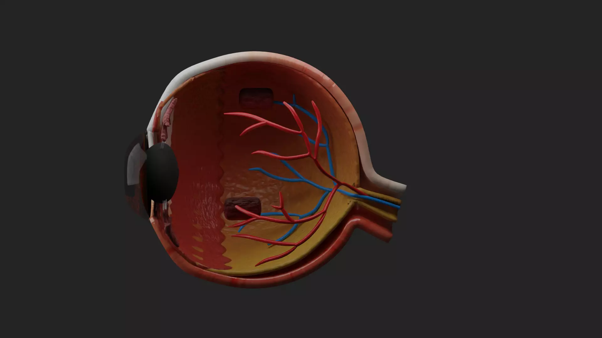 Cataract Eye Anatomy  3D model_8