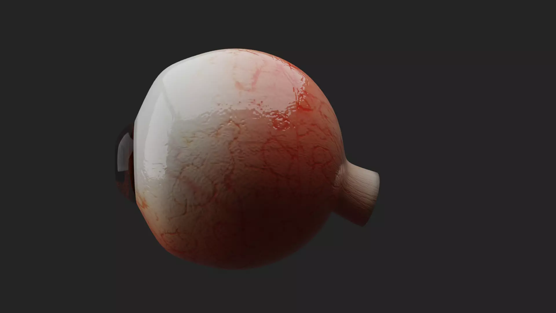 Cataract Eye Anatomy  3D model_6