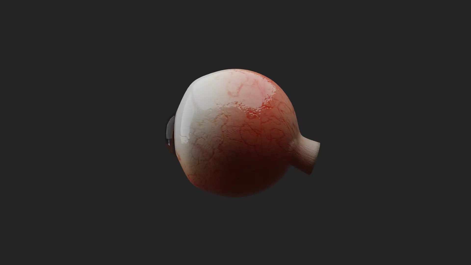 Cataract Eye Anatomy  3D model_12