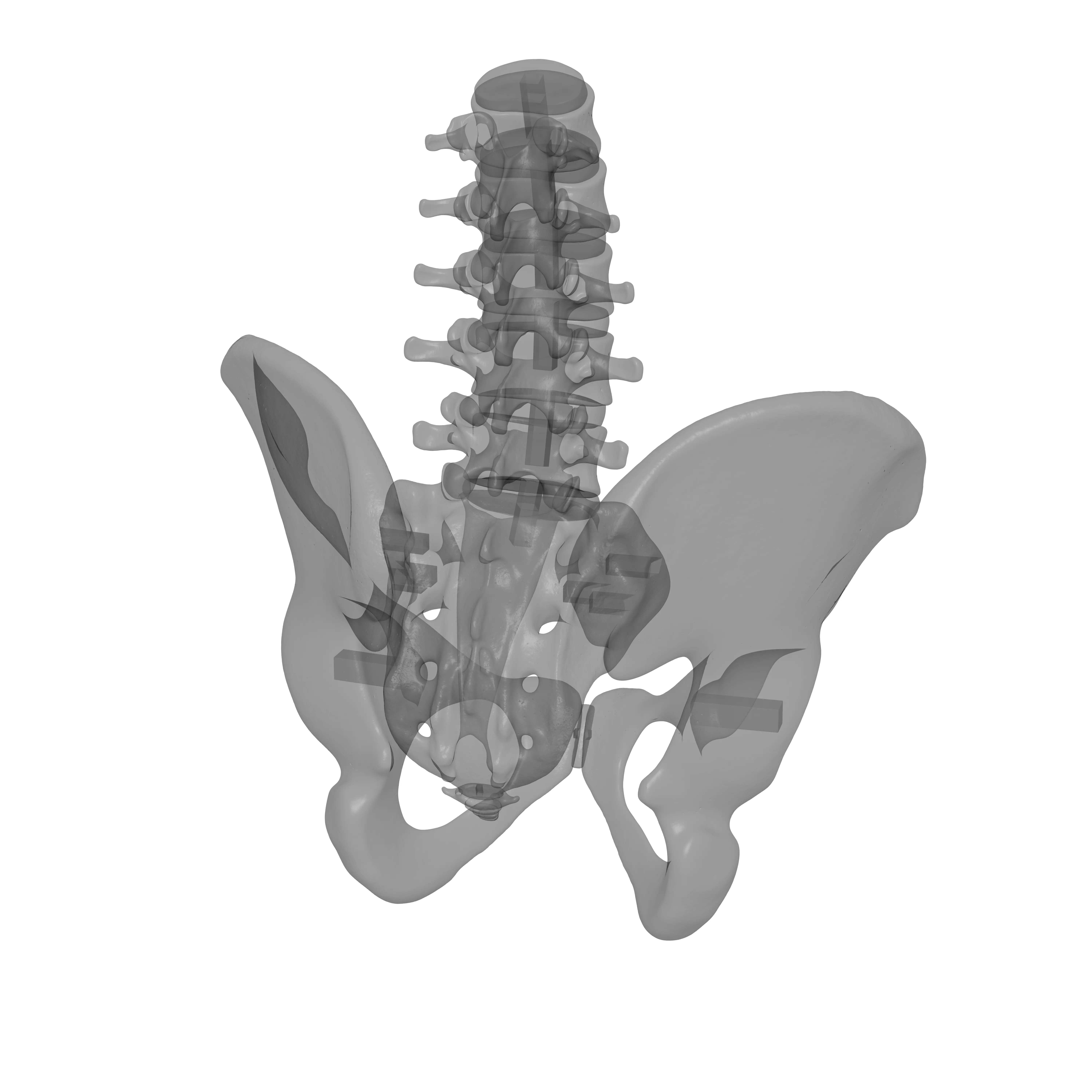 Lumbar Spine - Ilium 3D print model_20