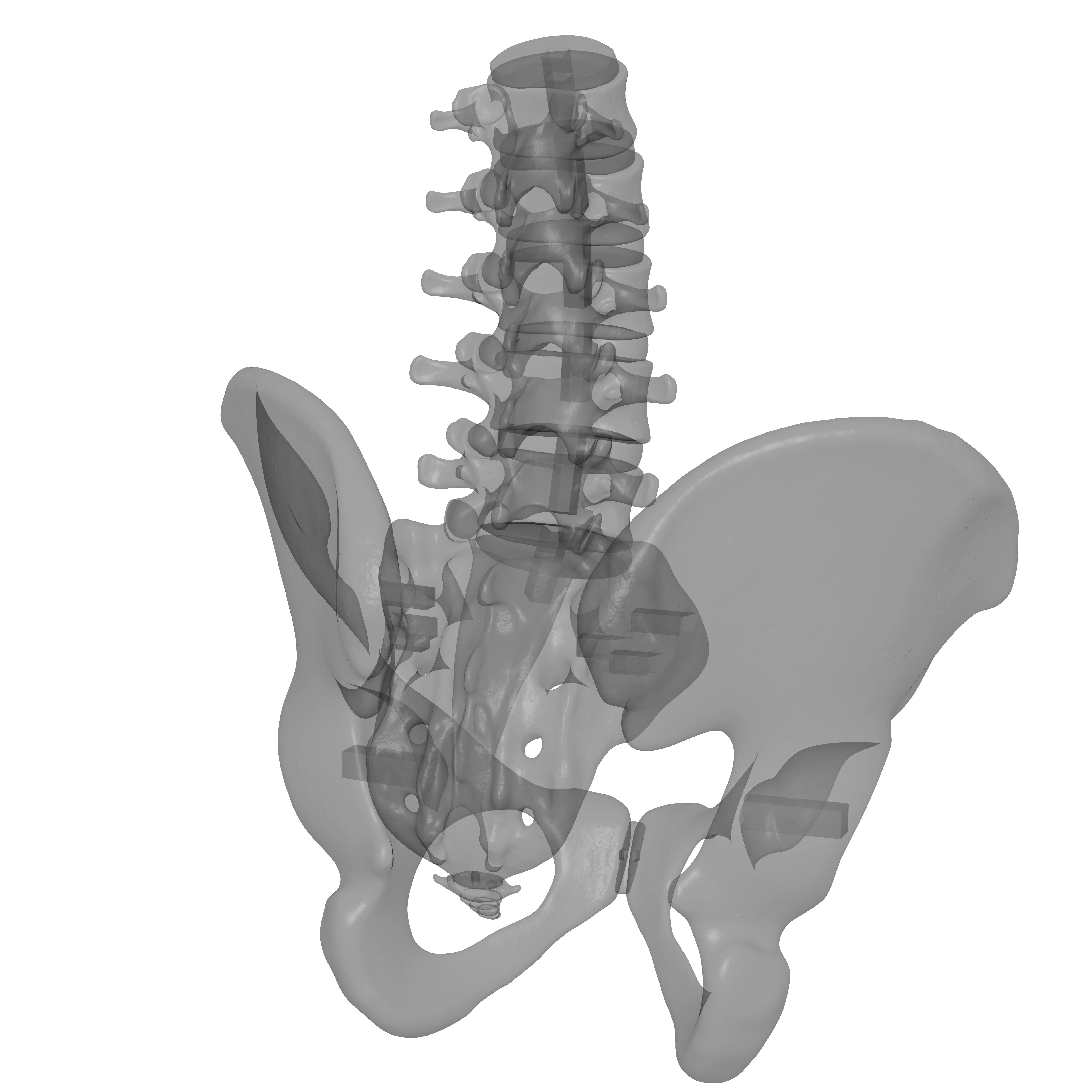 Lumbar Spine - Ilium 3D print model_22