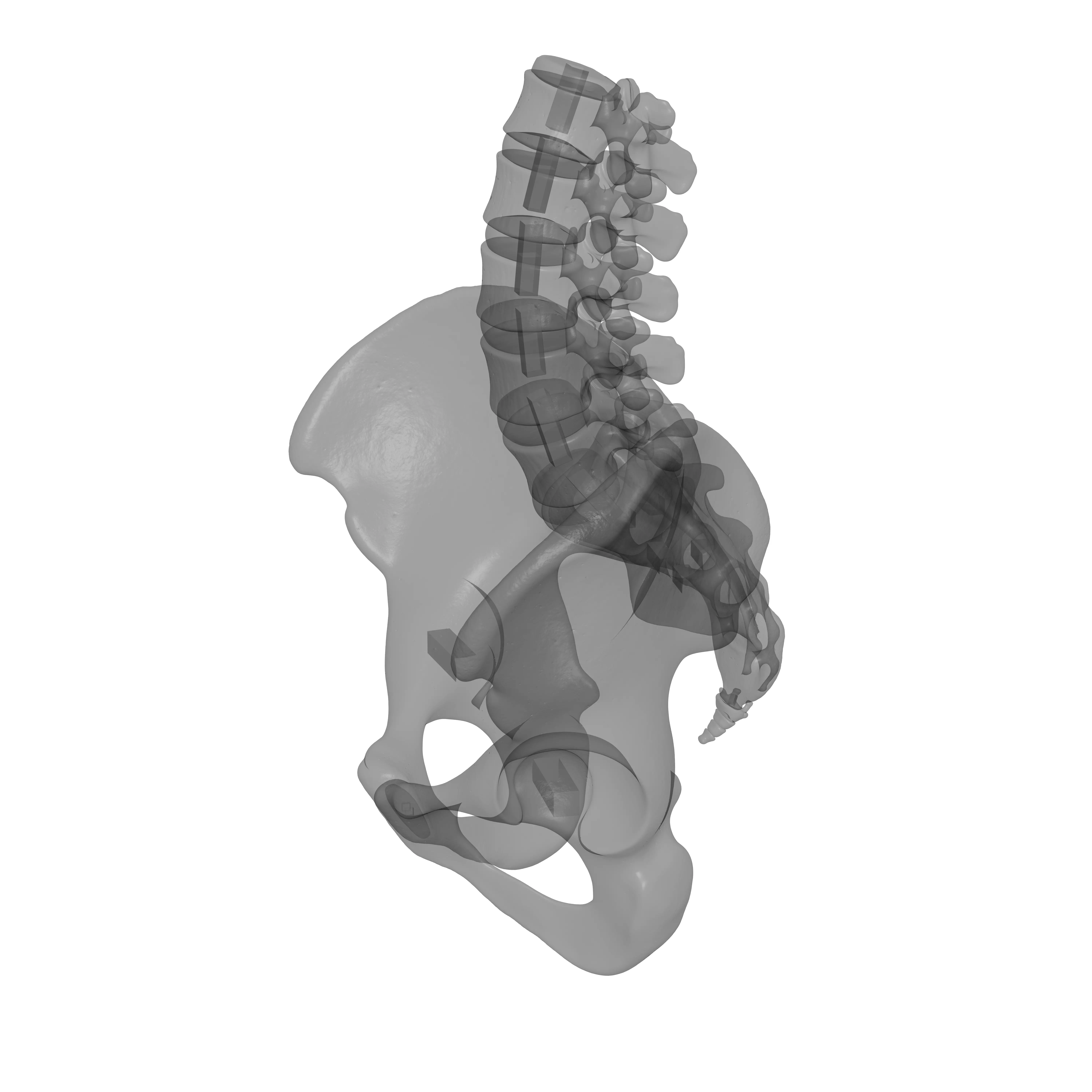 Lumbar Spine - Ilium 3D print model_17